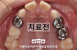 수술전