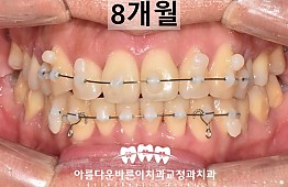 수술후