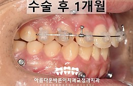 수술후