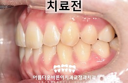 수술전