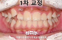 수술후