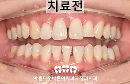 수술전