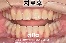 수술후