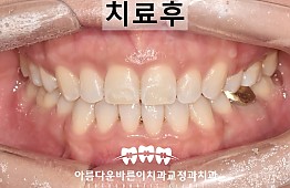 수술후