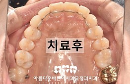 수술후