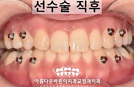 수술후