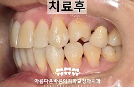 수술후