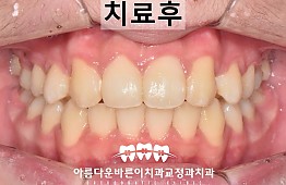 수술후