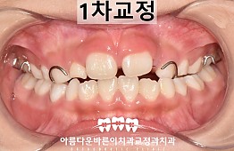수술후