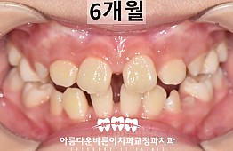 수술후