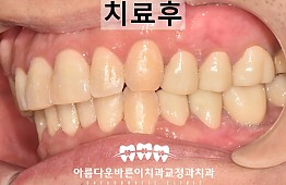 수술후