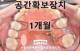 수술후