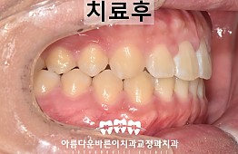 수술후