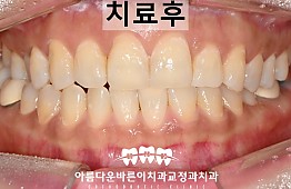 수술후