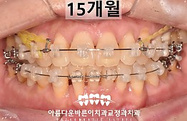 수술후