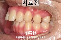 수술전