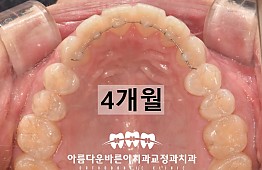 수술후