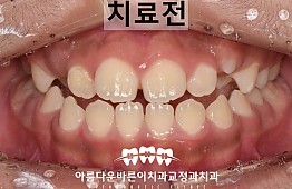 수술전