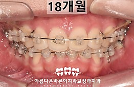 수술후