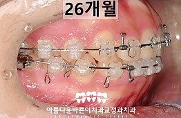 수술후