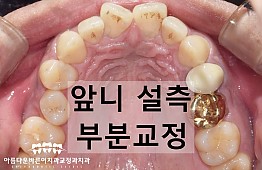 수술전