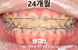 수술후