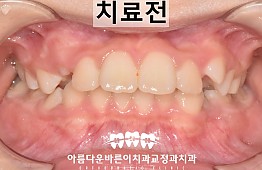 수술전