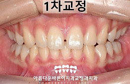 수술후