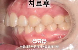 수술후