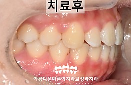 수술후