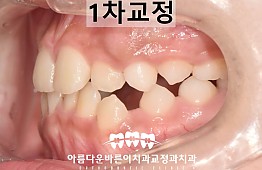 수술후