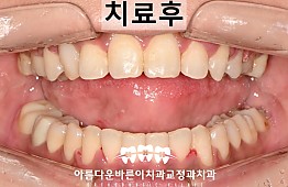 수술후