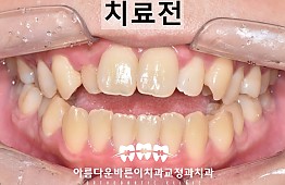 수술전