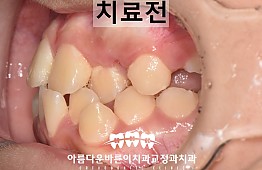수술전