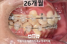수술후