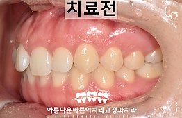 수술전