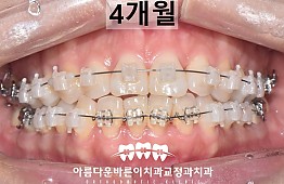 수술후