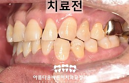 수술전