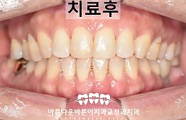 수술후