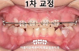 수술후