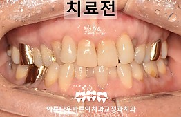 수술전