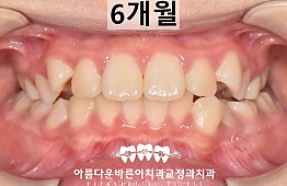 수술후