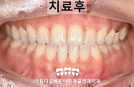 수술후