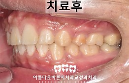 수술후