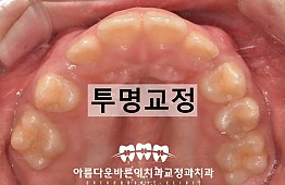 수술후