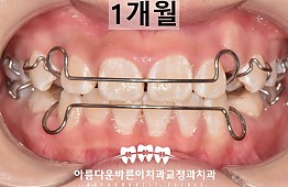 수술후