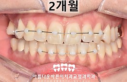 수술후