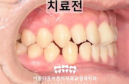 수술전