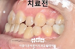 수술전