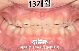 수술후